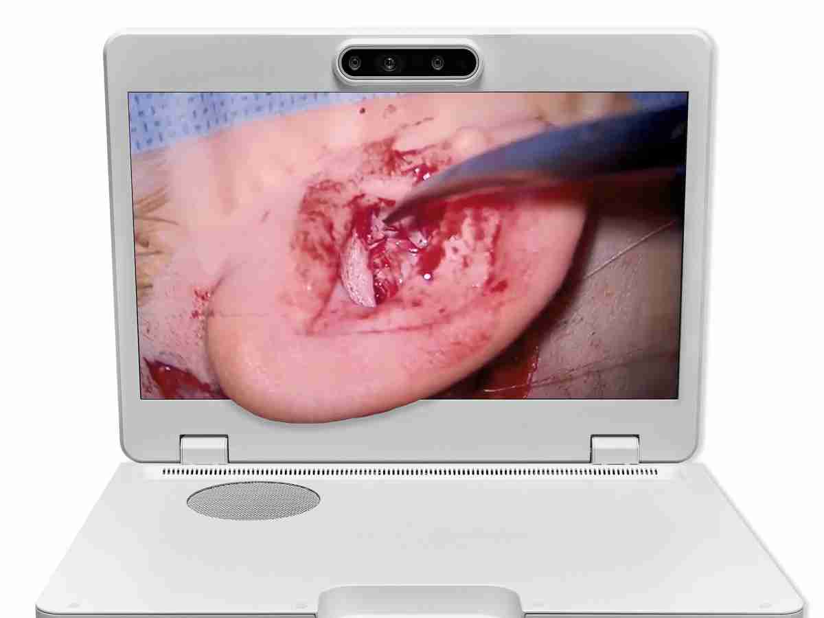 达擎之＂Heads-up 3D显微手术显示系统＂，，整合4K裸眼3D显示及眼球追踪系统，，，具备快速追踪人眼移动位置功能，，，减轻医师长时间维持固定姿势的负担，，，，让医师能有更宽广清晰的3D立体视野及更舒适的姿势来执行手术。。。